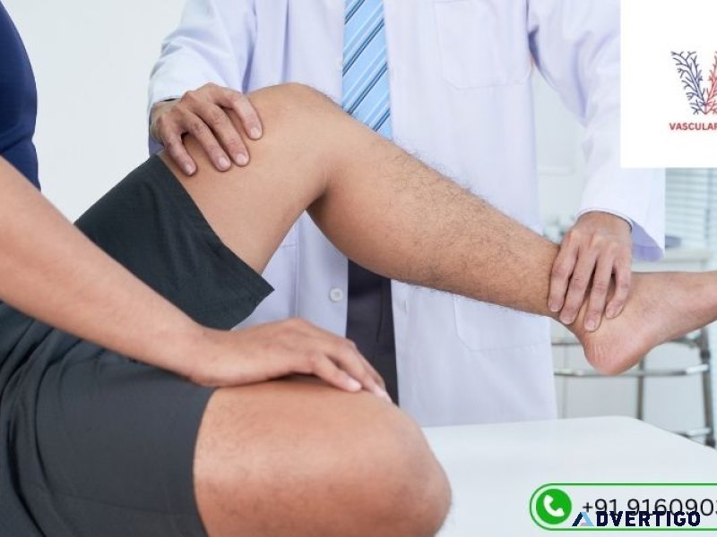 Leg pain specialist doctor in hyderabad | vascularhyd