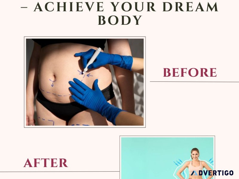 Expert liposuction surgery in bangalore