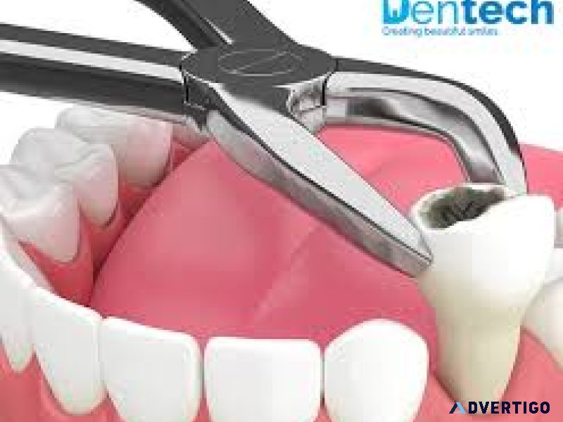 Tooth extraction abudhabi