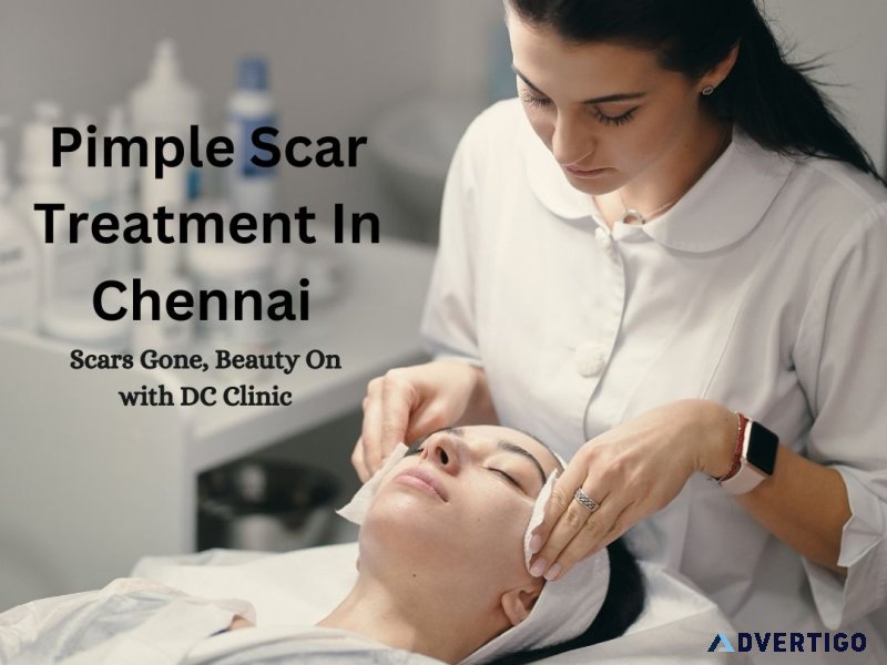 Acne treatment in chennai