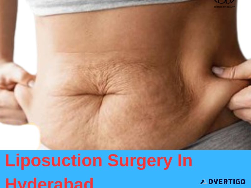 Best liposuction surgery in hyderabad | transform your body tod