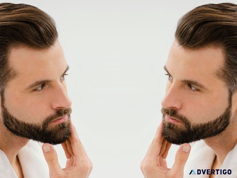 Beard hair transplant: to change your style