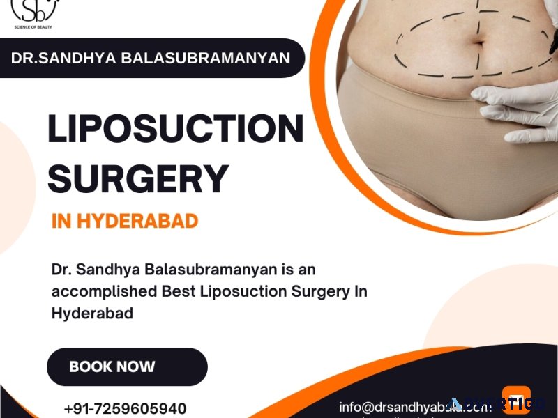 Transform your body with expert liposuction surgery in hyderabad