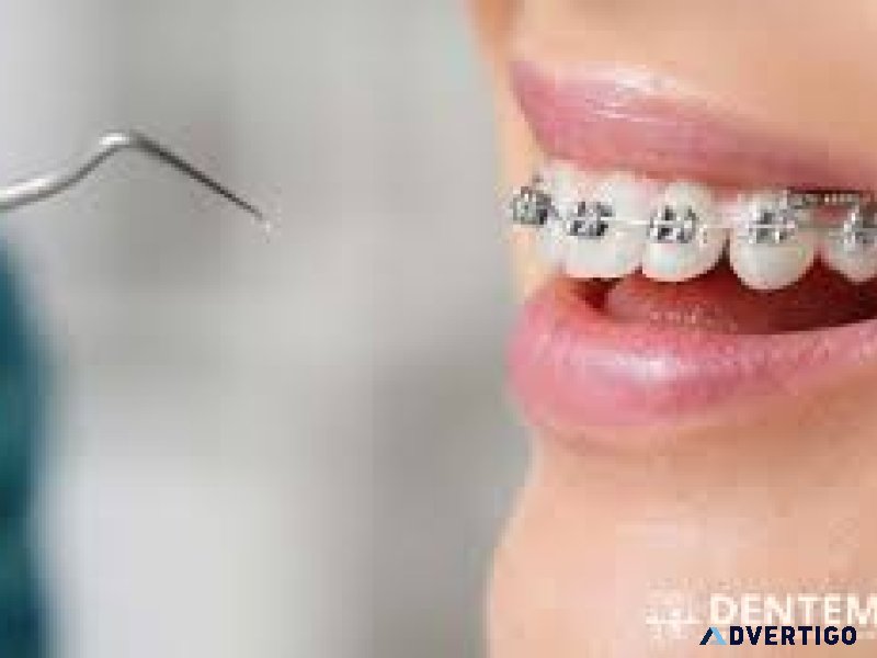 Orthodontic treatment abudhabi