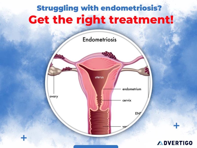 Best endometriosis treatment in hyderabad | dr vindhya gemaraju