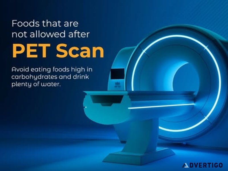 Best pet ct scan centre in delhi | easy book my lab