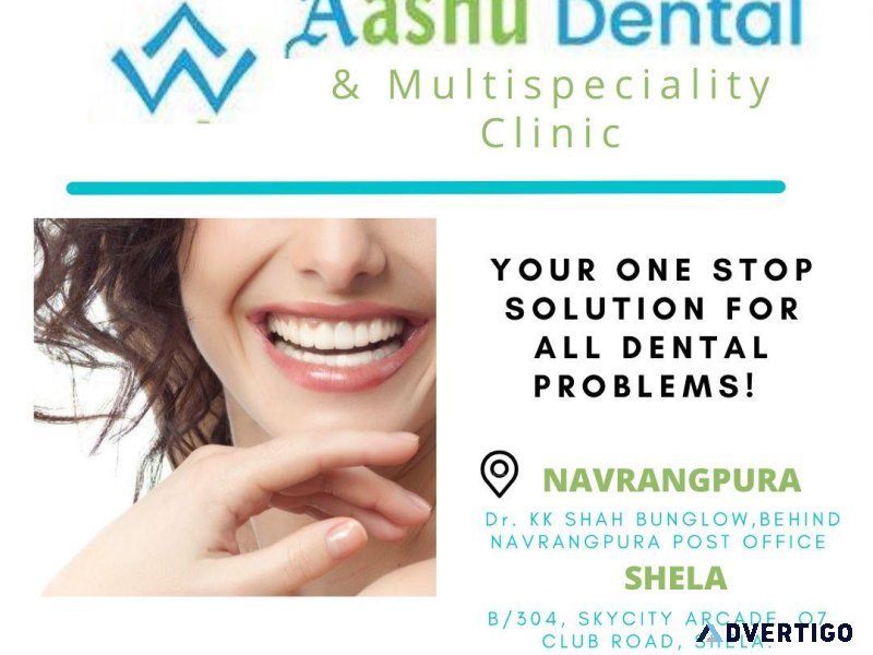 Dental implants, braces & root canal — expert dentist in ahmedab