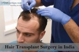 Hair Transplant Surgery in India