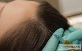 Top PRP Hair Fall Treatment In Ludhiana  DrShikhaAggarwal