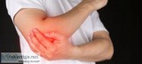 How Can Physiotherapy Help with Tendinitis