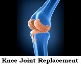 Best Hospital for Joint Replacement in Ahmedabad