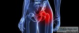 Best Hip Joint Replaceement Surgery In Ahmedabad