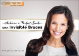 Invisible Braces A Clear Way to a Beautiful Smile