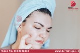 Best Skin Care Center in Banjarahills