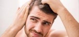 Reliable Male Hair Loss Treatment at Alopeciacure