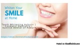 Teeth Whitening treatment Auburn  tooth whitening   Sunrise Dent