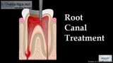 Root Canal Treatment in Ahmedabad