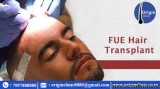 fue hair transplant in hyderabad  fue hair transplantation in hy