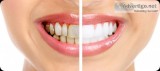 Best Dental Clinic in Ghaziabad  Book Appointment Now