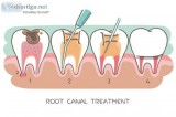 Get available one of the best Root Canal Specialist in south Kol