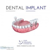 Dental implants in Ahmedabad  Best Dental Implants in Ahmedabad