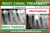 Dr. Philip Memoli - Root Canal Alternative Treatment  Holistic D