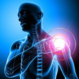 Shoulder Physical Therapy in Bergen County NJ