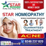 homeopathy treatment for skin allergy