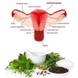 Polycystic Ovarian Disease Ayurvedic Remedies  Obstetrics Clinic