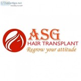 Hair transplant in jalandhar