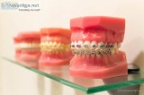 Invisalign Valencia