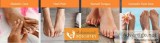 Plainview Laser Toenail Fungus Treatment