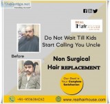 Hair Wigs in Delhi