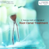 Why do you need Root Canal Treatment  Vasant Vihar