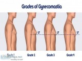 Gynecomastia Surgery India - Book Your Consultation