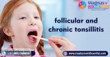 Follicular and chronic tonsillitis treatment in Hyderabad