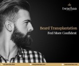 Why Should You Opt for Beard Hair Transplant