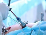 Gynae laparoscopic surgeon in jaipur