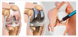 We have the best orthopedic doctor in jaipur