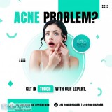 Acne scar reduction in bangalore