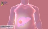 Liver cancer treatment in mumbai