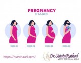 Dr. sujata rathod | best uterus removal specialist in thane