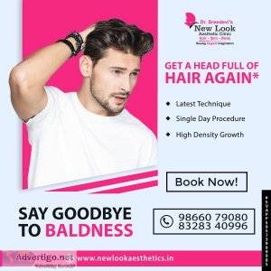 Best hair transplant clinic in hanamkonda