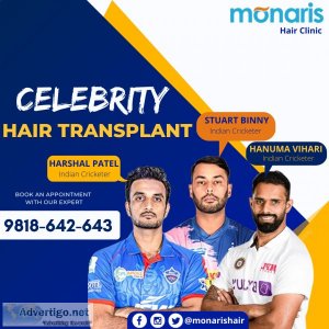 Hair transplant in indore