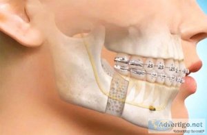 Best cosmetic dentist in hyderabad l faceclinics