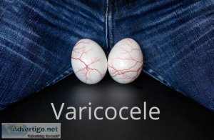 Advanced varicocele surgery in bhopal