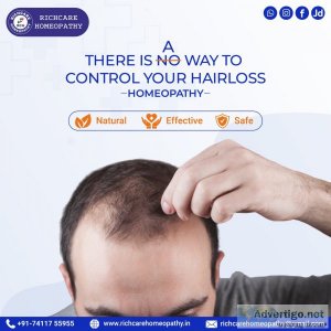 Homeopathy treatment | hair fall solution for all hair condition