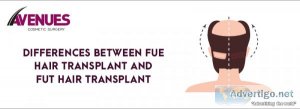 Differences between fue and fut hair transplant