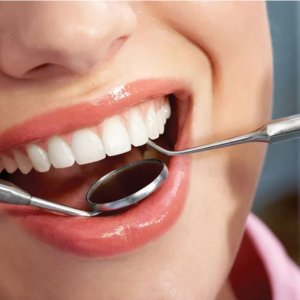 Teeth cleaning in abu dhabi