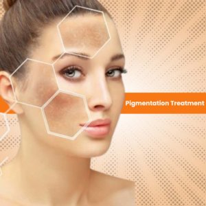 Before and after: real results from pigmentation treatment kits